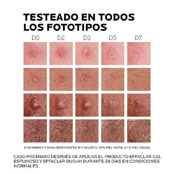 La Roche-Posay Effaclar Duo +M 40Ml
